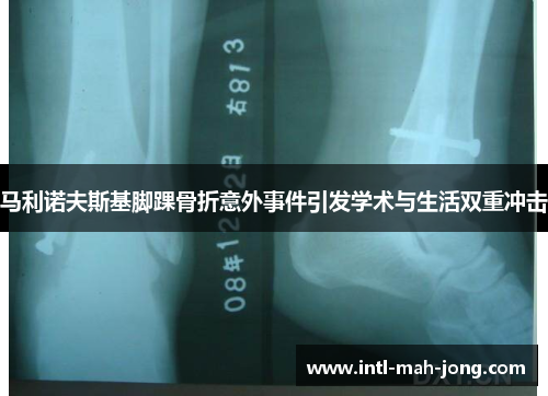 马利诺夫斯基脚踝骨折意外事件引发学术与生活双重冲击